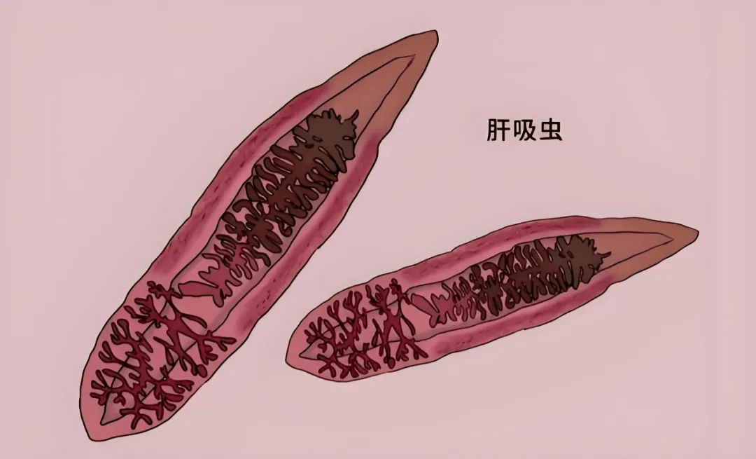 肝吸虫,学名华支睾吸虫,它的体型小巧,成虫呈葵花籽状,半透明