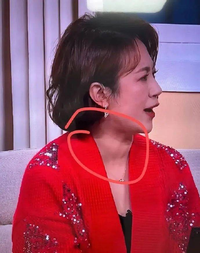 热搜第一，马丽疑似甲状腺肿大，本人回应