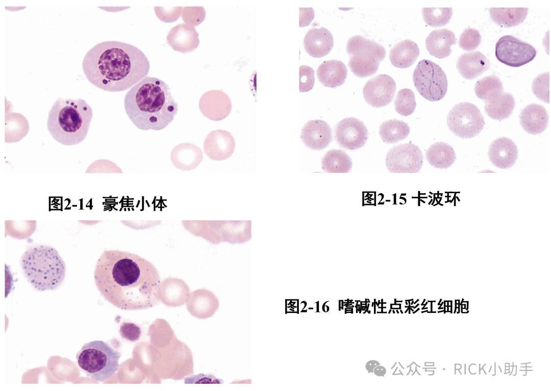 血液常规检验