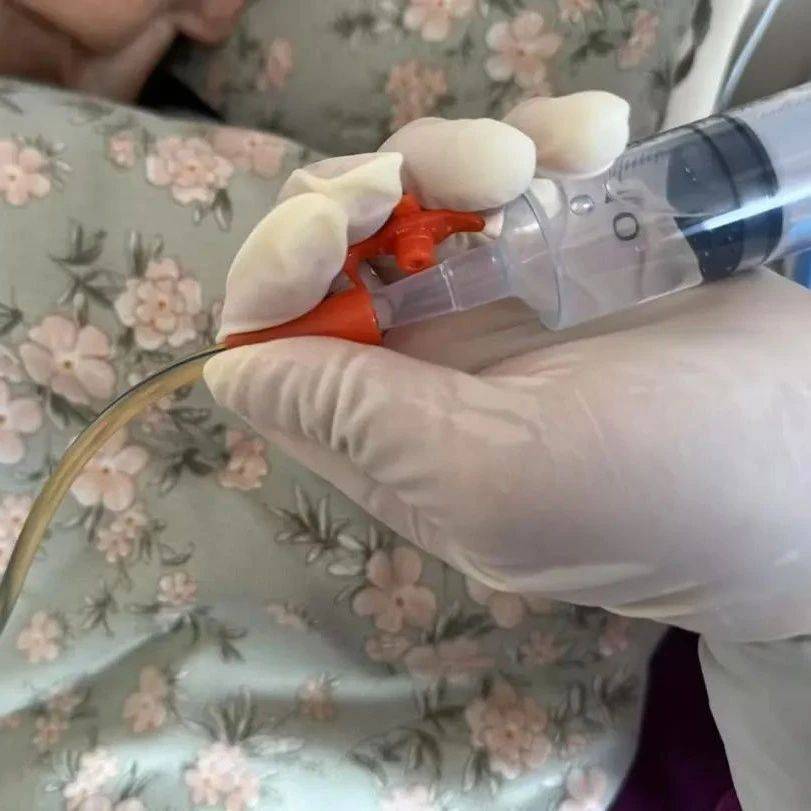 居家鼻饲全攻略：从配置到操作，一文读懂！限时收藏｜贤医健康说_患者_食物_营养
