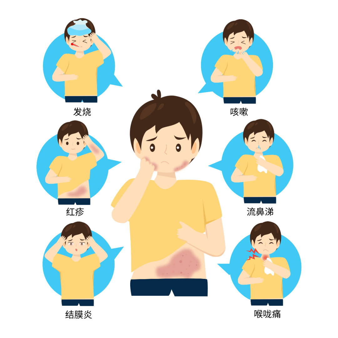 麻疹:被遗忘的杀手