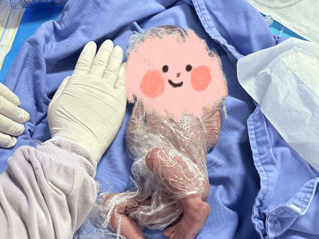 成都市第五人民医院成功救治一名仅820g的超低体重早产儿