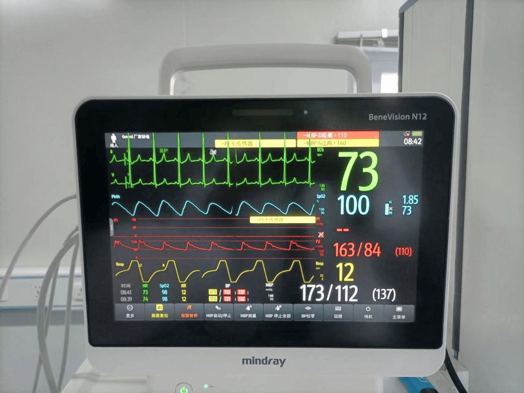 多功能监护仪有创呼吸机床旁crrt床旁彩超2