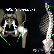 命门与尾闾_丹田_推手_调节