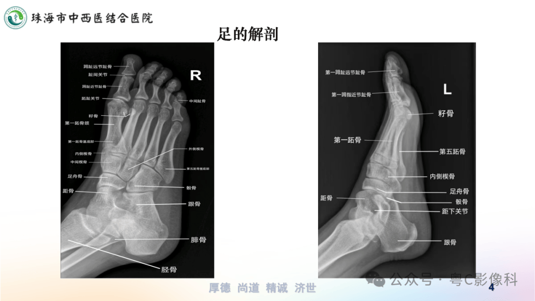 足的x线检查正侧斜位及负重位