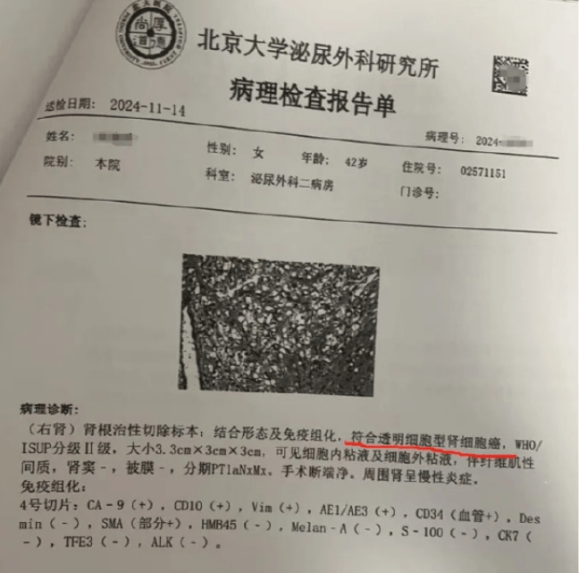 “女子体检10年无异常，却确诊癌症晚期”，体检机构最新回应