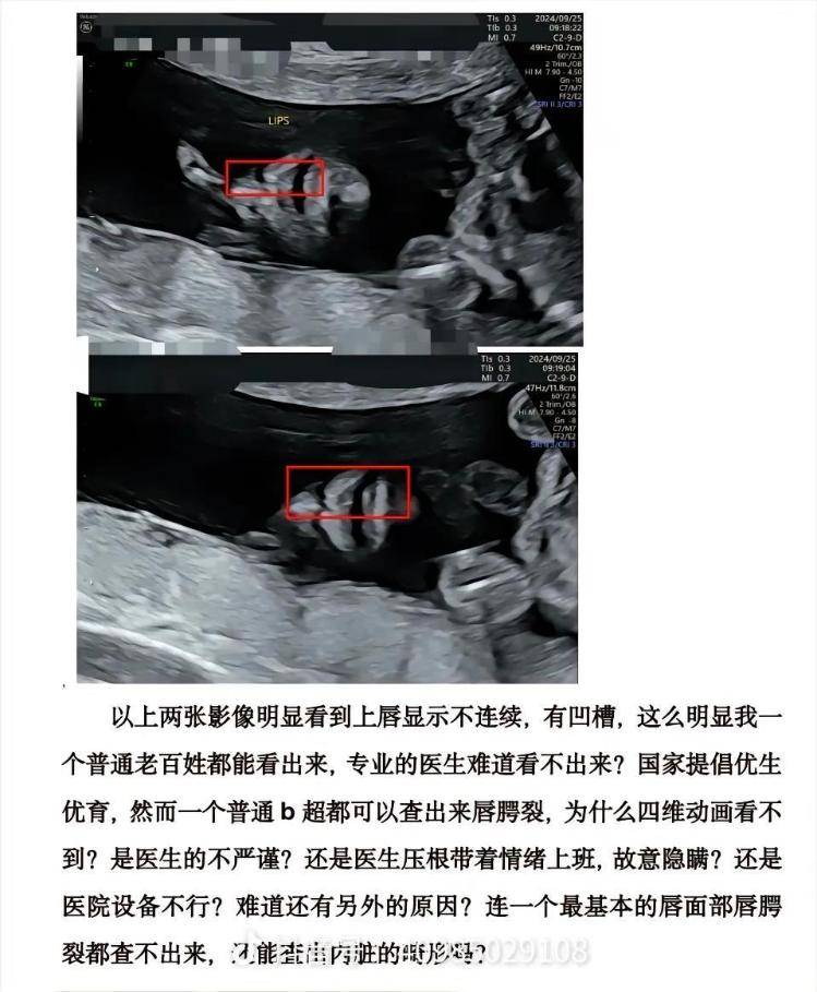 桂林女子称彩超漏诊婴儿唇裂，到卫健委反映问题竟遭怒斥，涉事医院：彩超未看出任何问题
