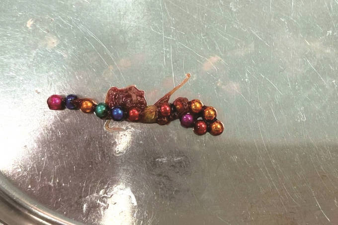 孩子吃了6颗磁力珠_孩子吃了磁力珠一年了没事吧（孩子吃了磁力珠多久有症状吗）