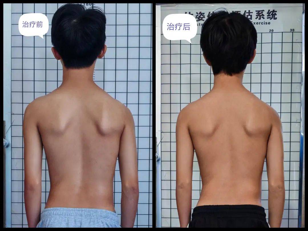 案例对比报名方式5第二期:8月13日