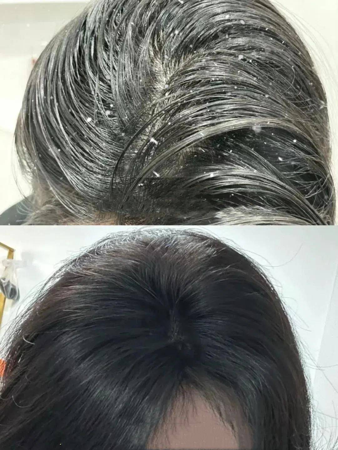 控油去屑洗发水品牌排行榜?去屑控油打造蓬松美扎发