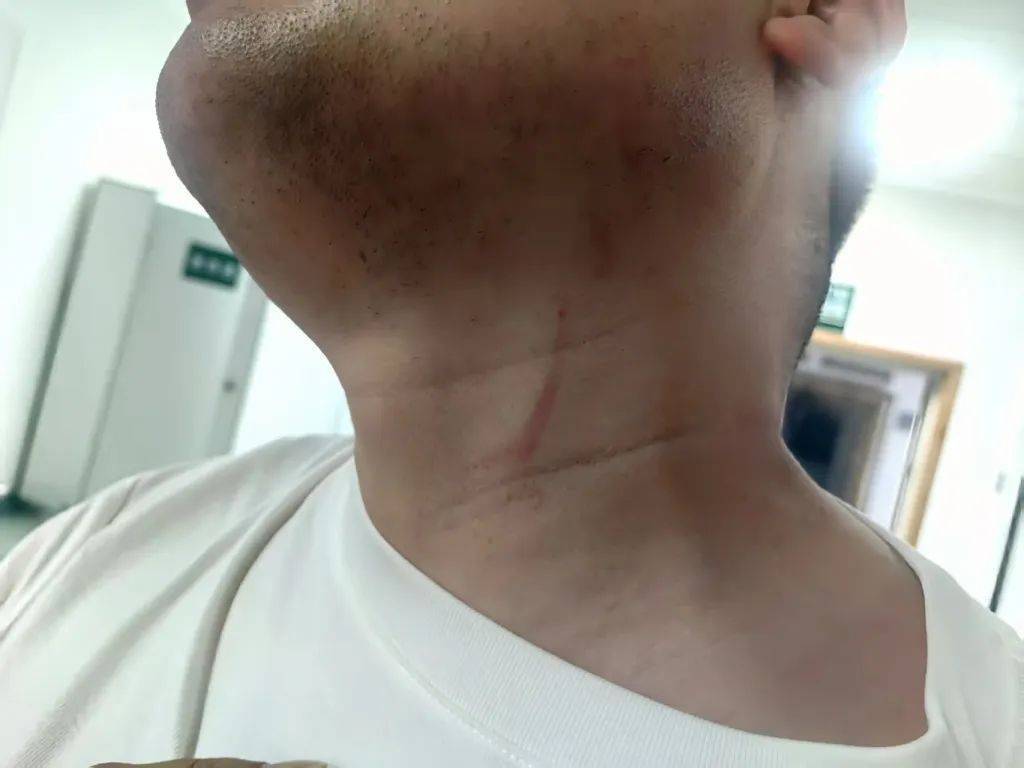 男子拍摄违章占道遭抢夺手机并被锁喉殴打！警方：批评违章者并罚款500元