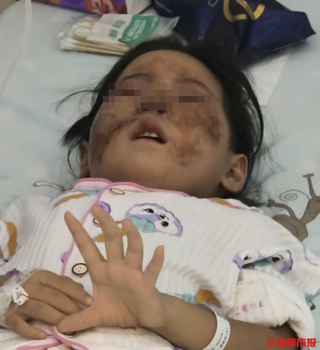 坐副驾不系安全带,5岁女童车祸中受伤