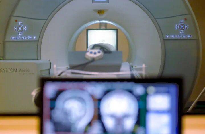 科学家发现逆转大脑衰老“开关”