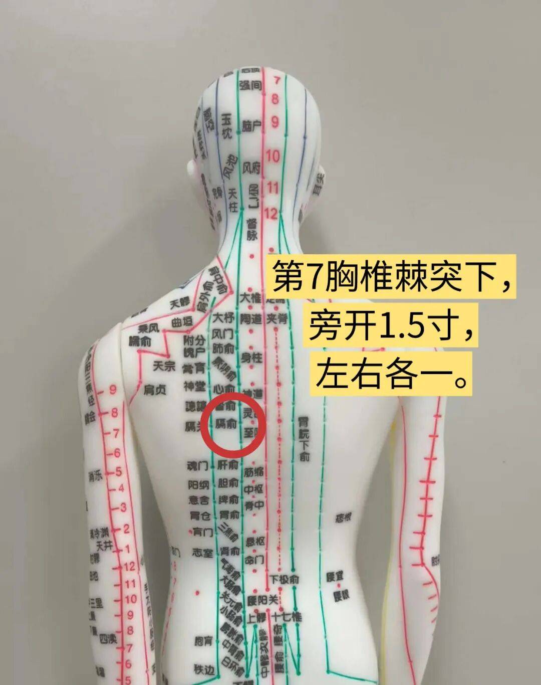 2艾灸疗法每次艾灸膈俞穴15～30分钟,每日1次