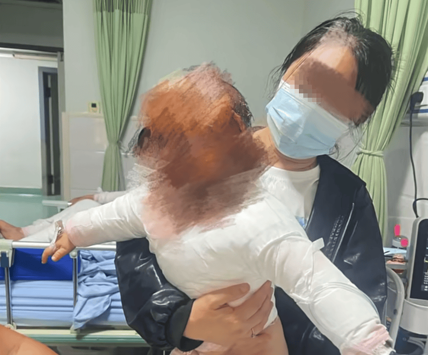警示案例|突然爆炸！全身40%大面积烫伤，这东西很多人家都有！