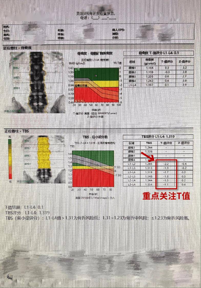 骨密度报告↓↓↓我们就能拿到自己"骨本金"结果一般做完的当天,建议