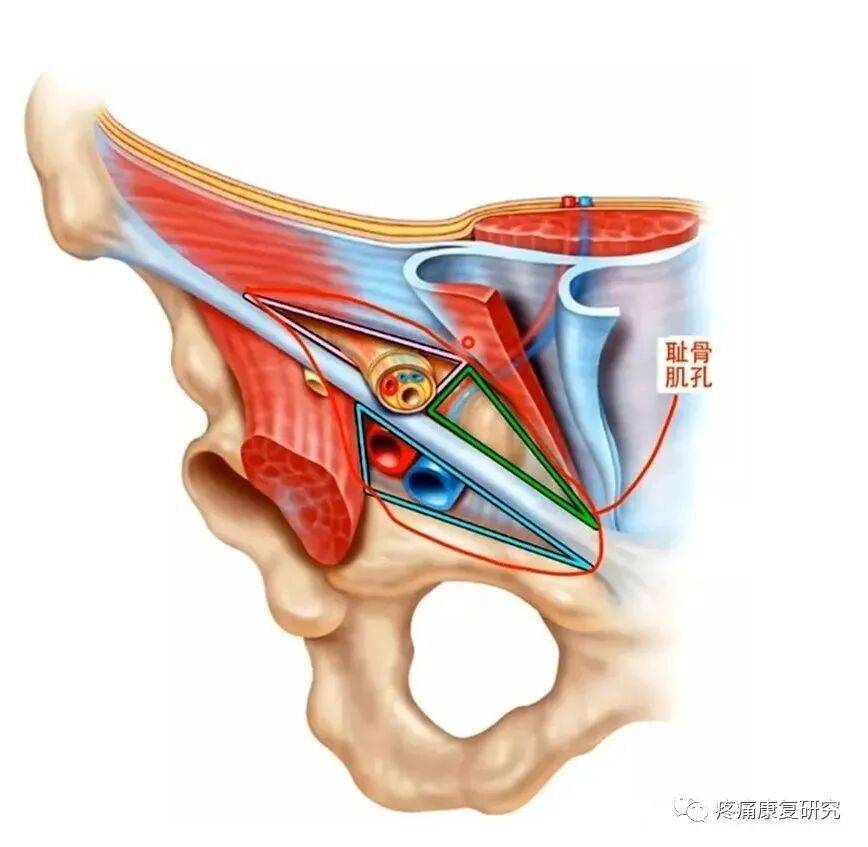 肌耻骨孔:上界为腹横肌弓,下界为耻骨梳韧带,仅由腹横筋膜覆盖,是直疝