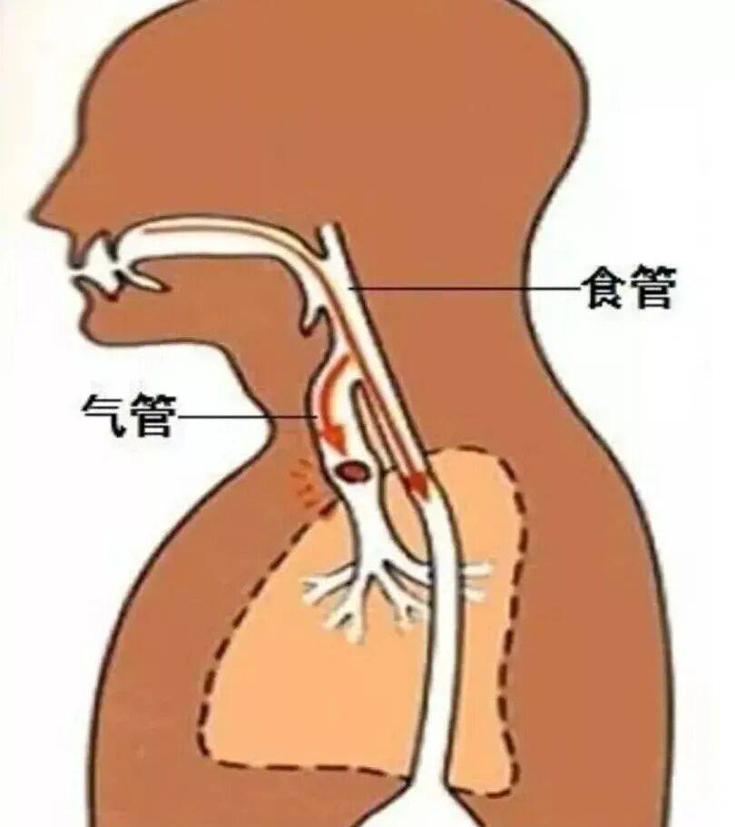 指甲_脚踝_食道