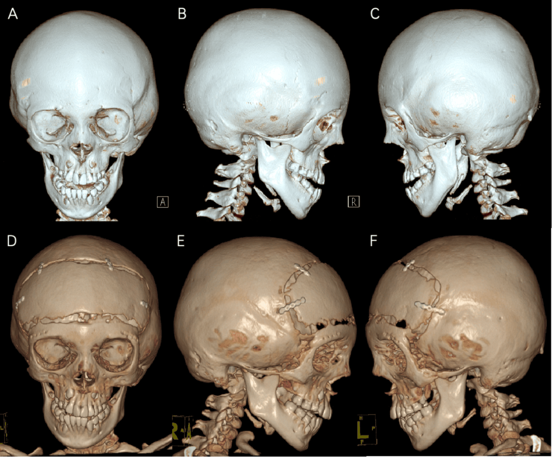 新华儿脑病例探秘第十一期