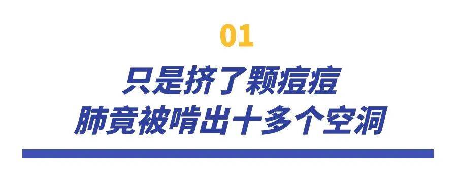 挤了颗痘痘，肺被“啃”出十几个洞！提醒：危险三角区千万别碰！