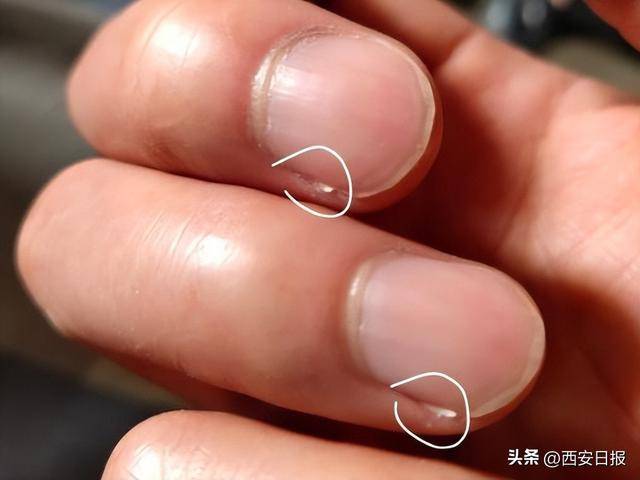 指甲有竖纹是肝不好？易断裂是缺钙？澄清6个指甲传言