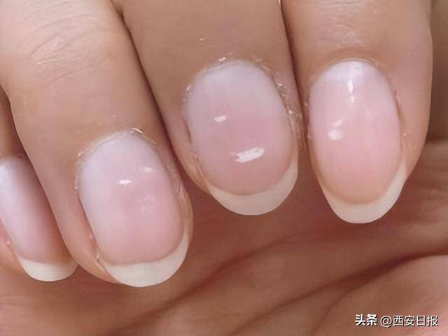 指甲有竖纹是肝不好？易断裂是缺钙？澄清6个指甲传言