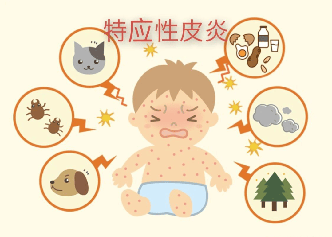 【健康科普】特应性皮炎（湿疹）总不好？原来和过敏关系这么大！_治疗_患者_脱敏