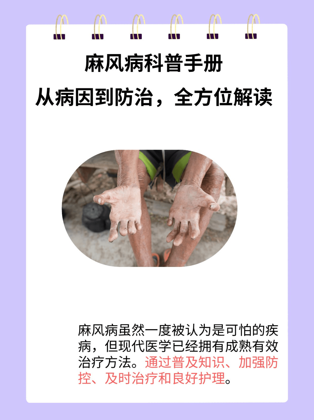 世界防治麻风病日