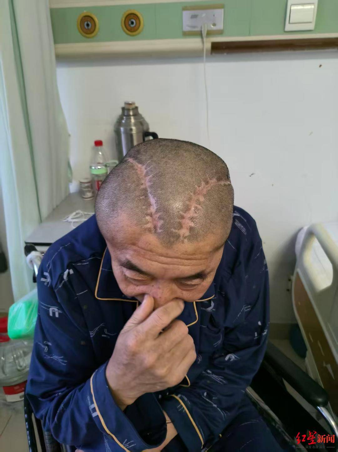 家属称男子三年前右脑出血被开左脑，医生发现出错又开右脑 希望认定责任、赔偿并追责