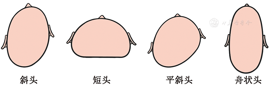 【标准·方案·指南】早产儿体位性颅型异常防治专家共识（2026）_进行_中华_新生儿