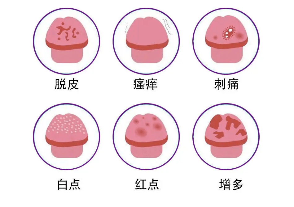 防范未然：五个关键措施预防男性生殖感染