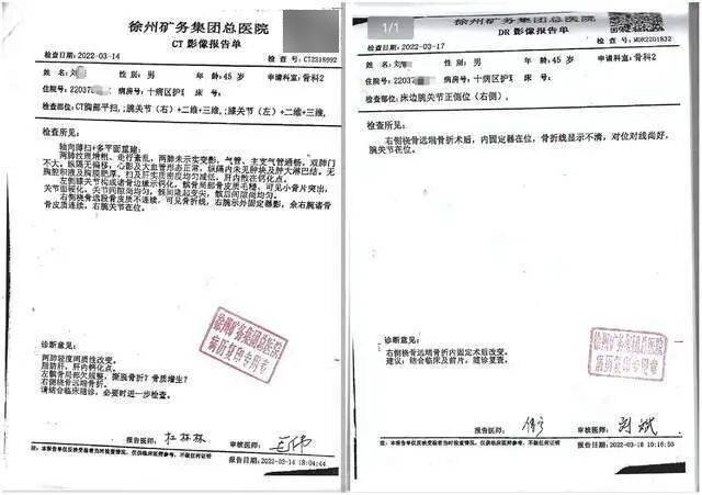 男子骨折手术数月后右手正中神经受损 病历被医院修改30次(图2)