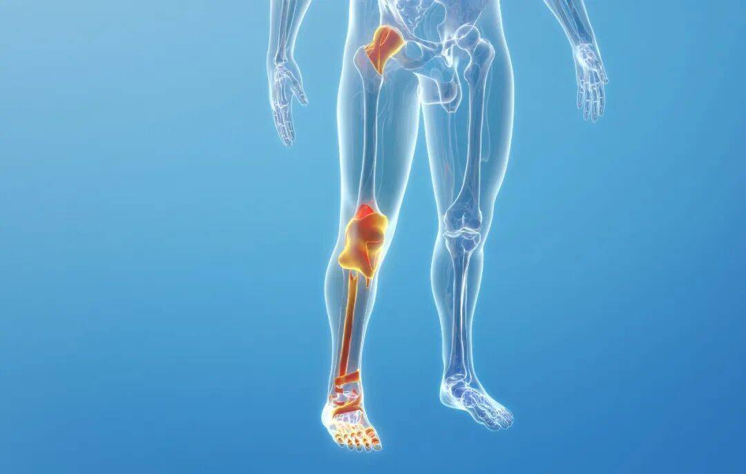 腿疼别总盯着“骨头”，可能是血管在报警