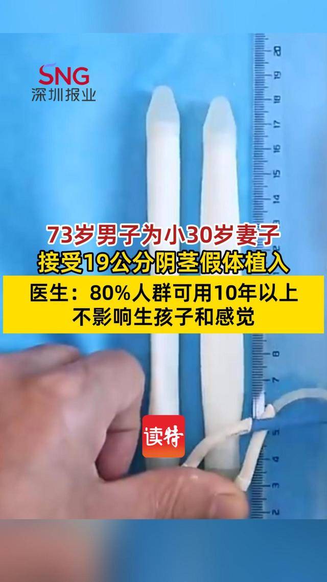 73岁男子为小30岁妻子植入19公分阴茎假体