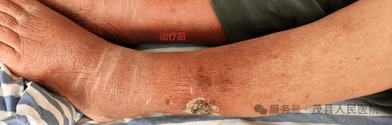 包含中日友好医院代挂专家号服务突发状况第一时间响应，不耽误病情的词条
