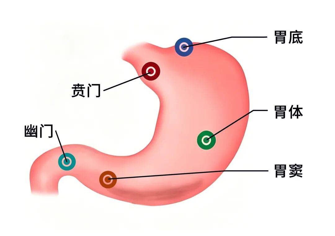 十人九胃？慢性胃炎反酸、腹胀，别硬抗！