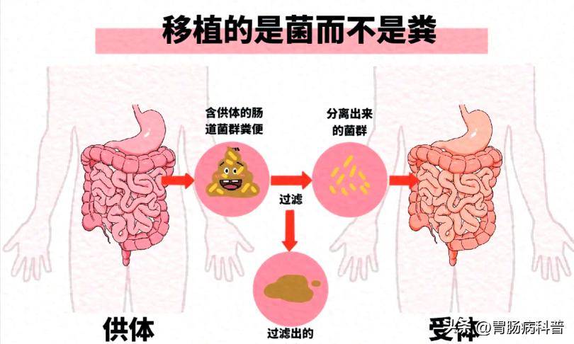 男人不行的源头竟在肠道？粪菌移植技术获成功，ED治疗迎来新拐点