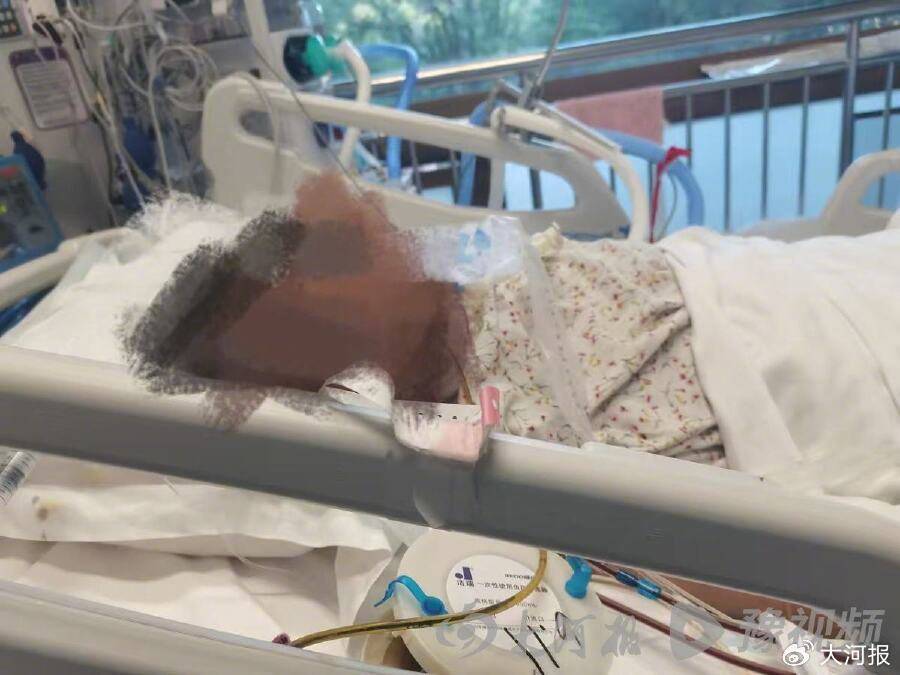 淄博周村区妇幼保健院产妇剖宫产呼吸心跳骤停 